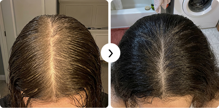 Crescimento capilar antes e depois