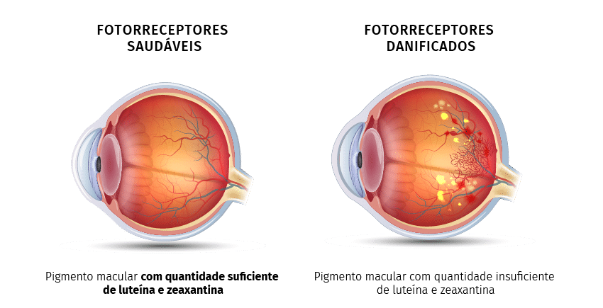 Eye PROtect 1+1 GRÁTIS